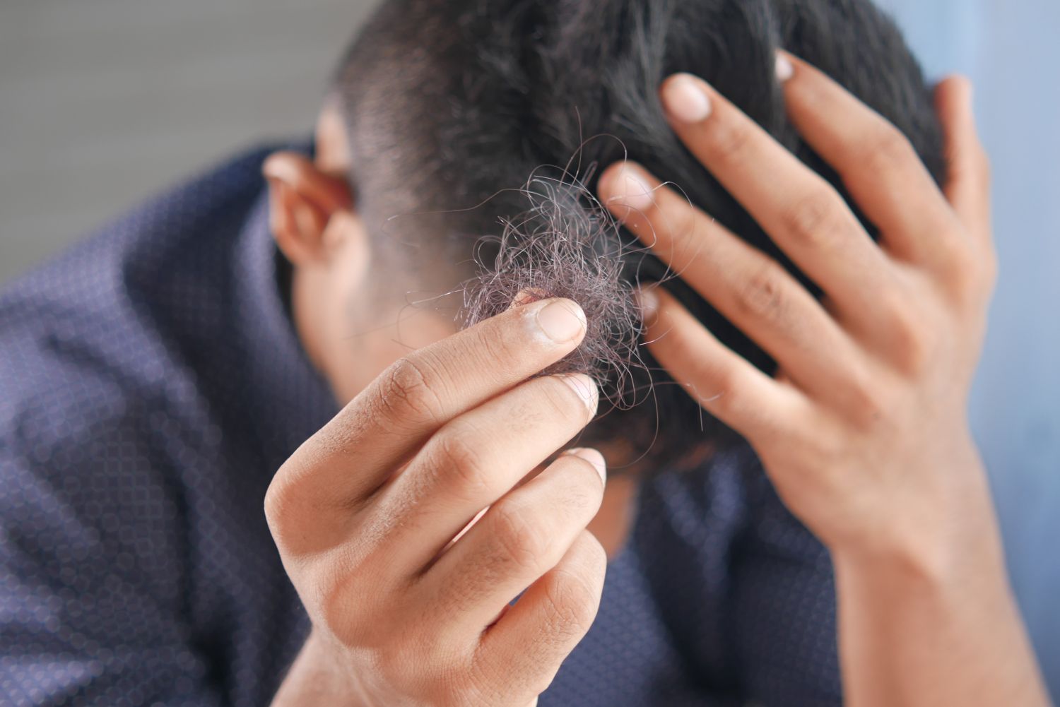 Causes of hair loss